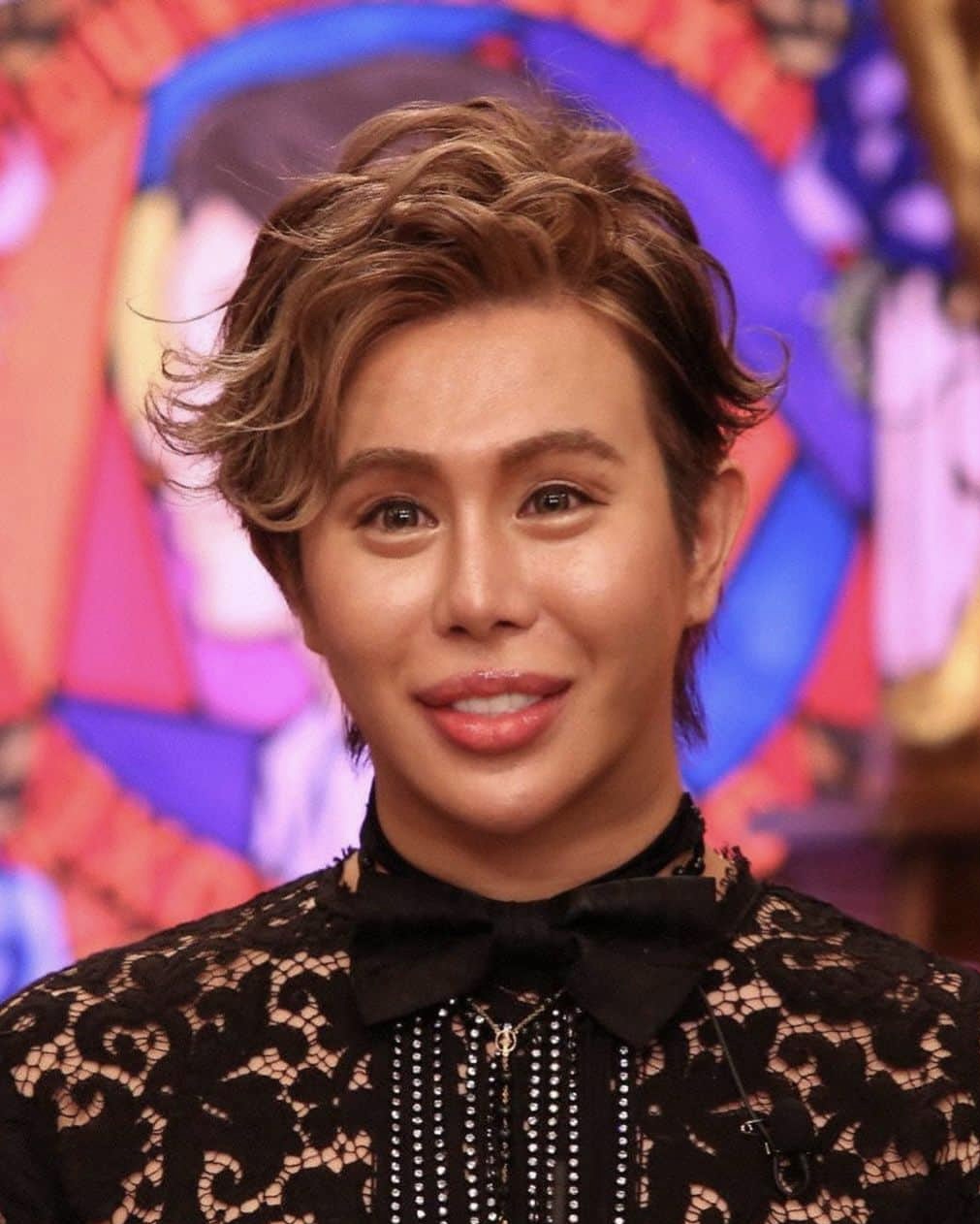 アレンの整形外科手術前の元の顔がイケメン 金持ちの理由は実家 収入源は Thetopics